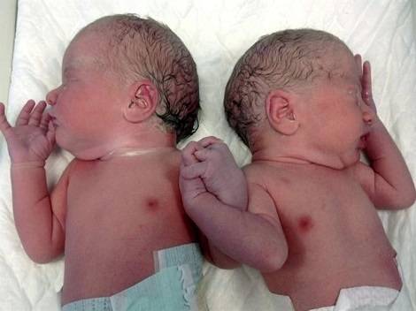 mellizos, un gesto de amor